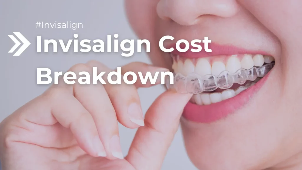 Invisalign Cost Breakdown Image