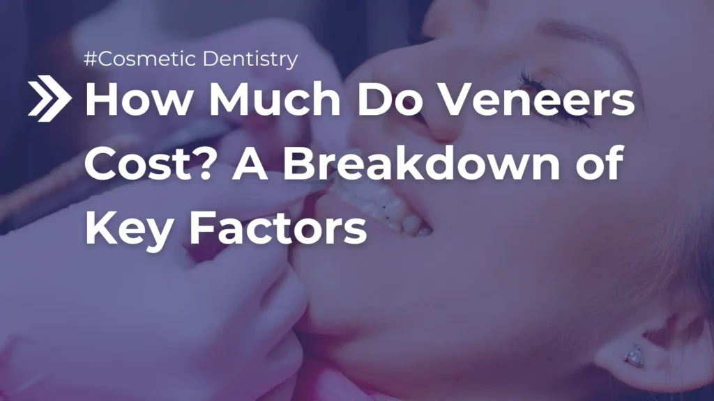 How Much Do Veneers Cost_ A Breakdown of Key Factors Image
