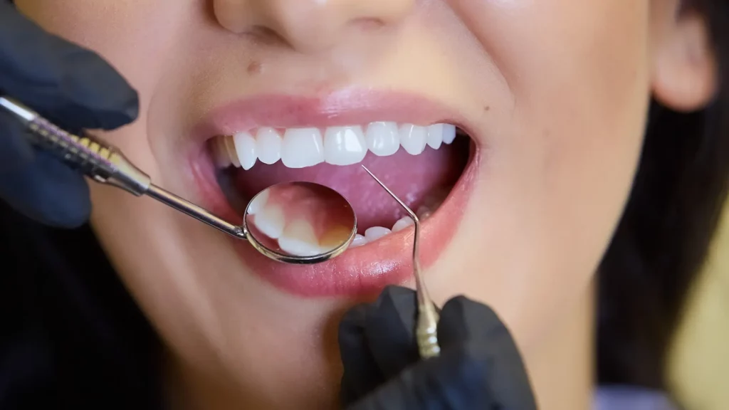 Dentist inspecting patient’s teeth with mirror