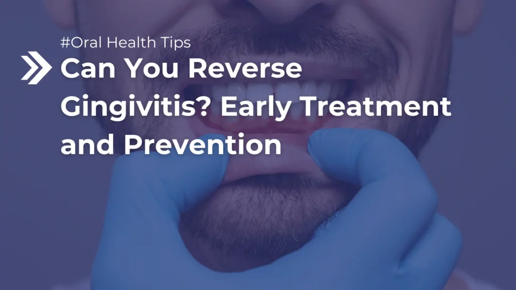Can You Reverse Gingivitis_ Early Treatment and Prevention Image