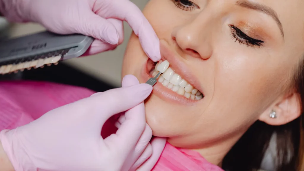 Dental Veneers vs. Crowns_ Key Differences Explained Image 2