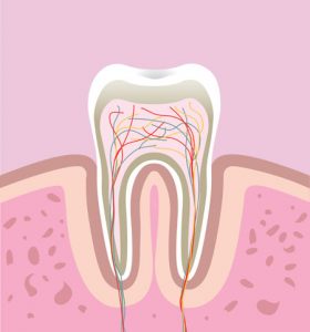 root_canal