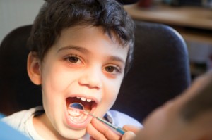 little boy with mouth opened at the dentist