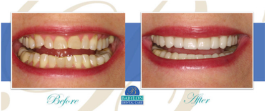 SNAP Technology Babylon Dental