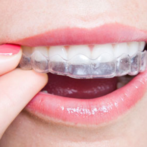 mouthguard-square