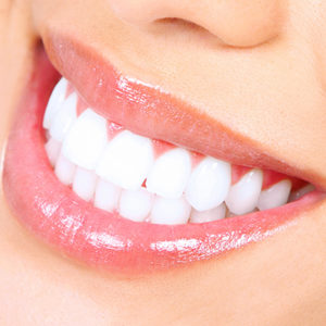 teeth-white-square