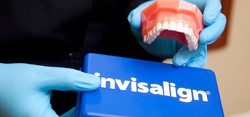 feature-image-invisalign2