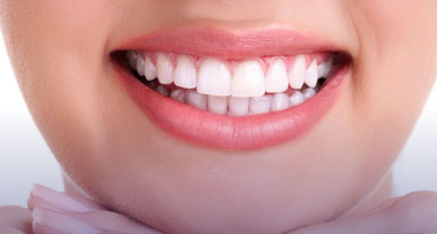 Woman's teeth