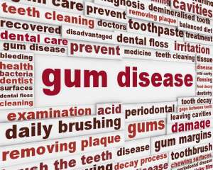 gum disease words