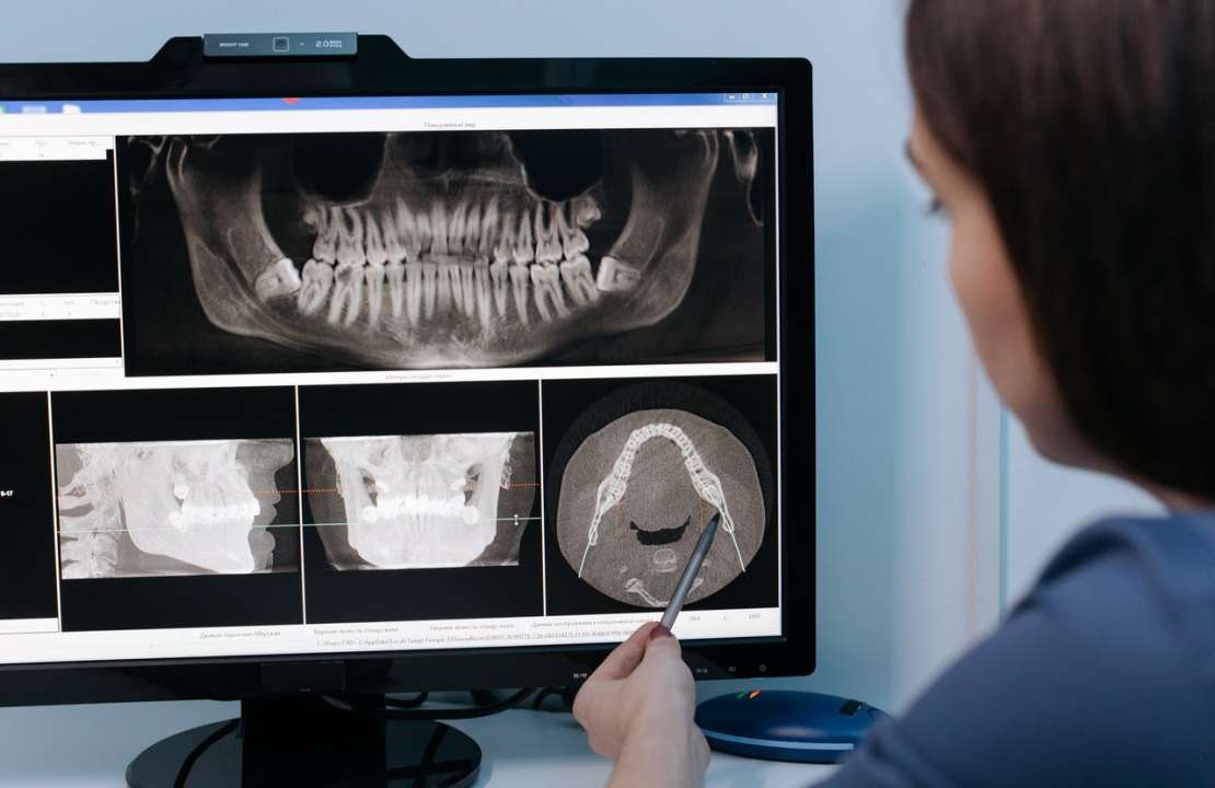 Dental X-ray