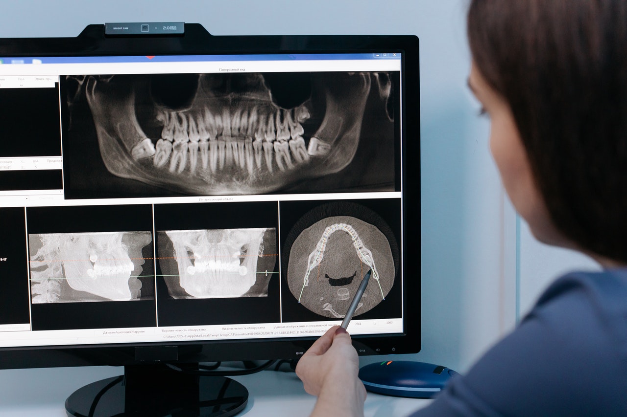 Dental X-ray