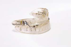 sleep apnea mouthpiece