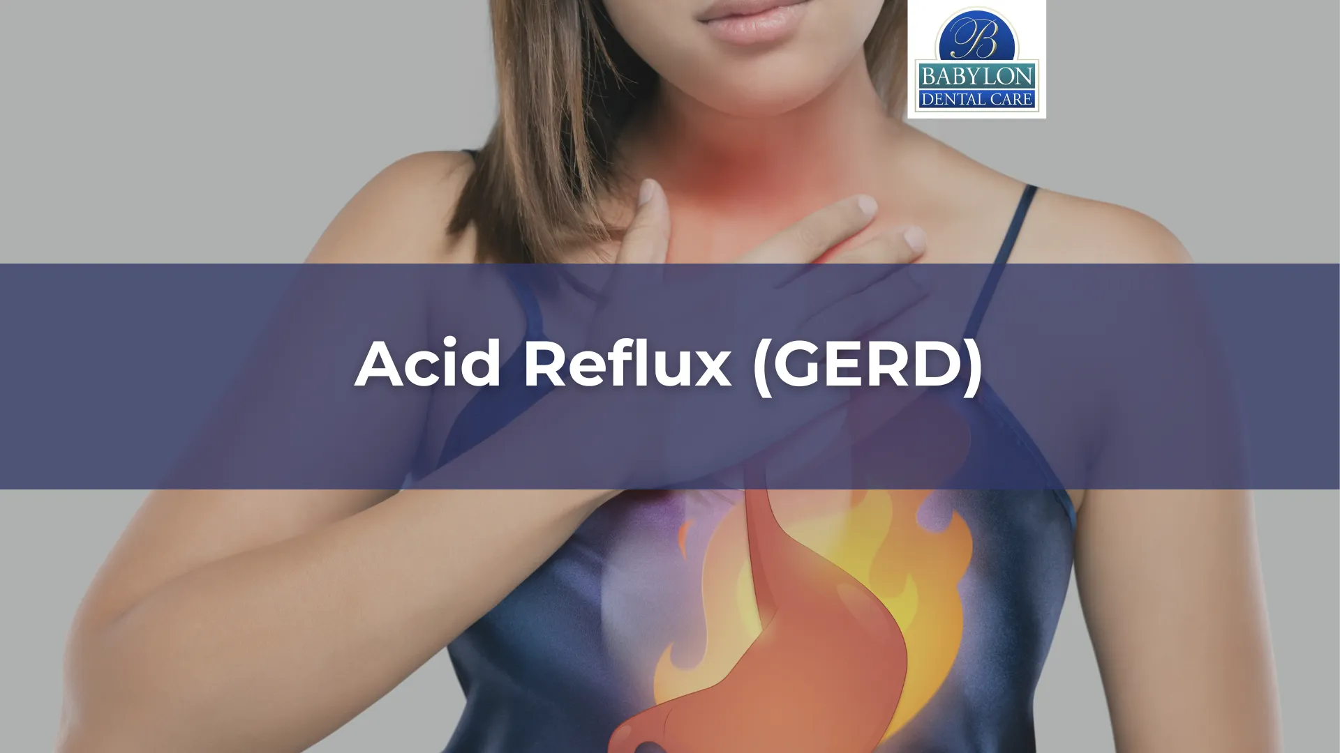 Acid Reflux (GERD)