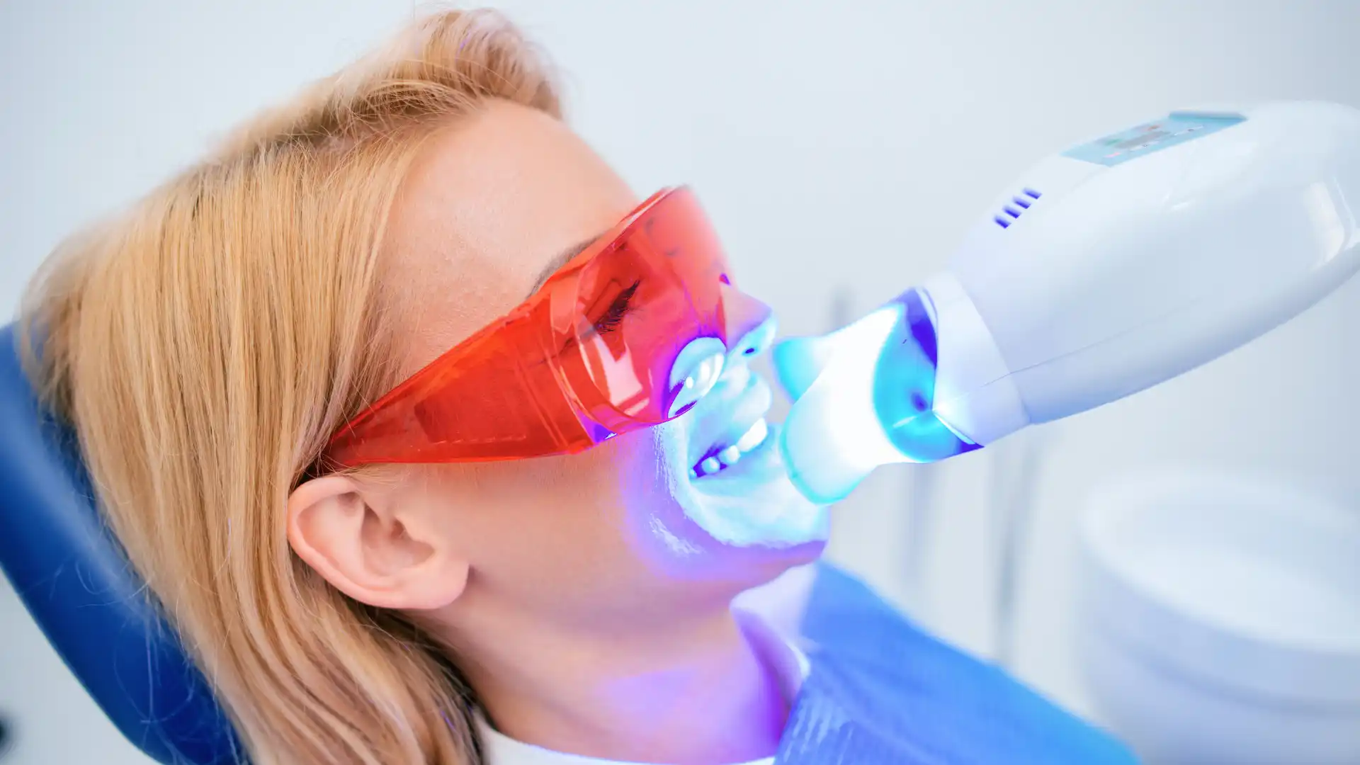 Woman undergoing professional teeth whitening treatment with protective eyewear.