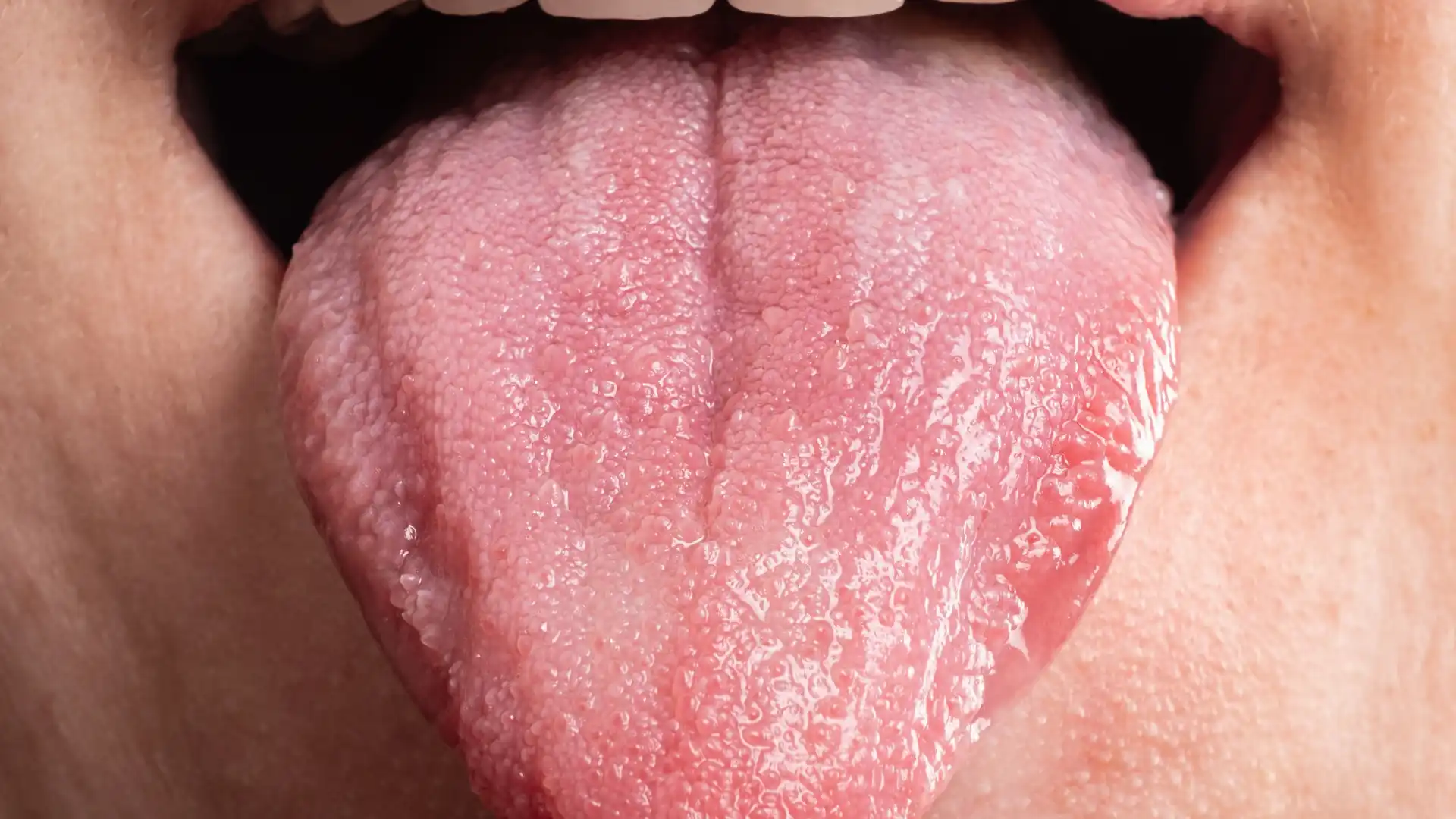 Close-up of a human tongue, displaying texture and surface details.