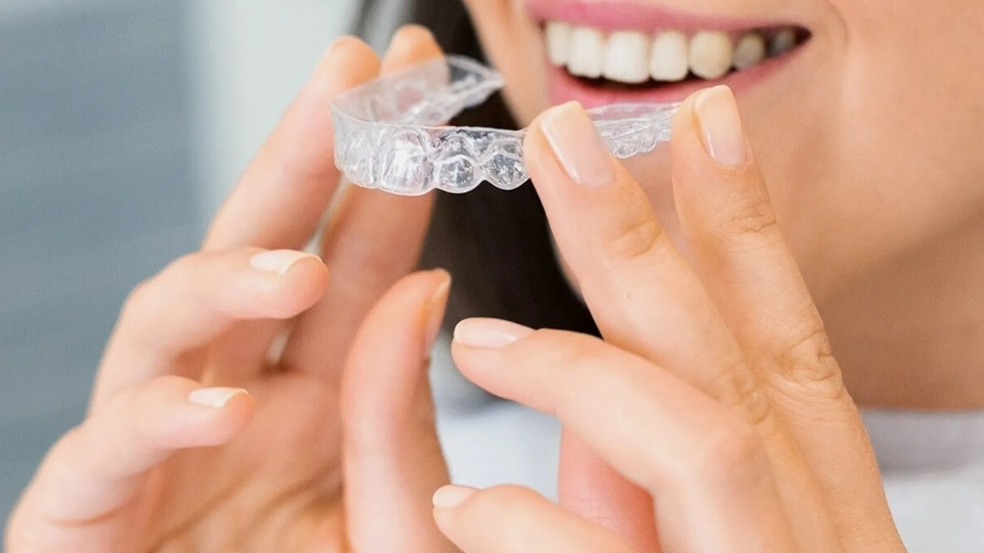 Invisalign Cost Breakdown image 2