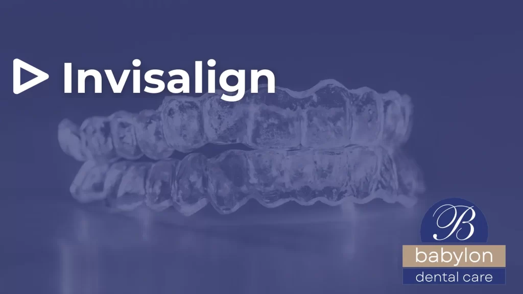 Invisalign