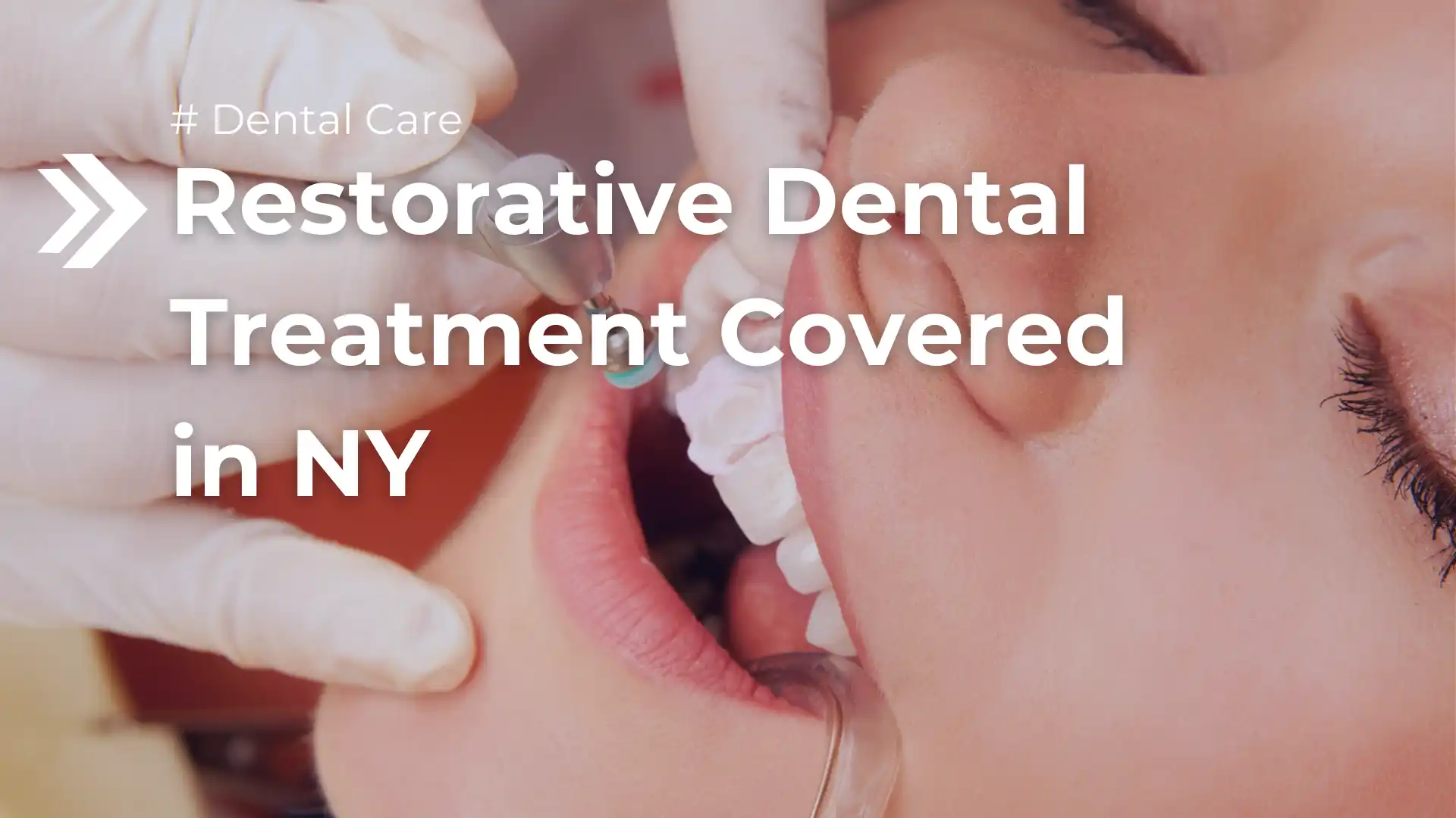 Restorative Dental Treatment Covered in NY Image