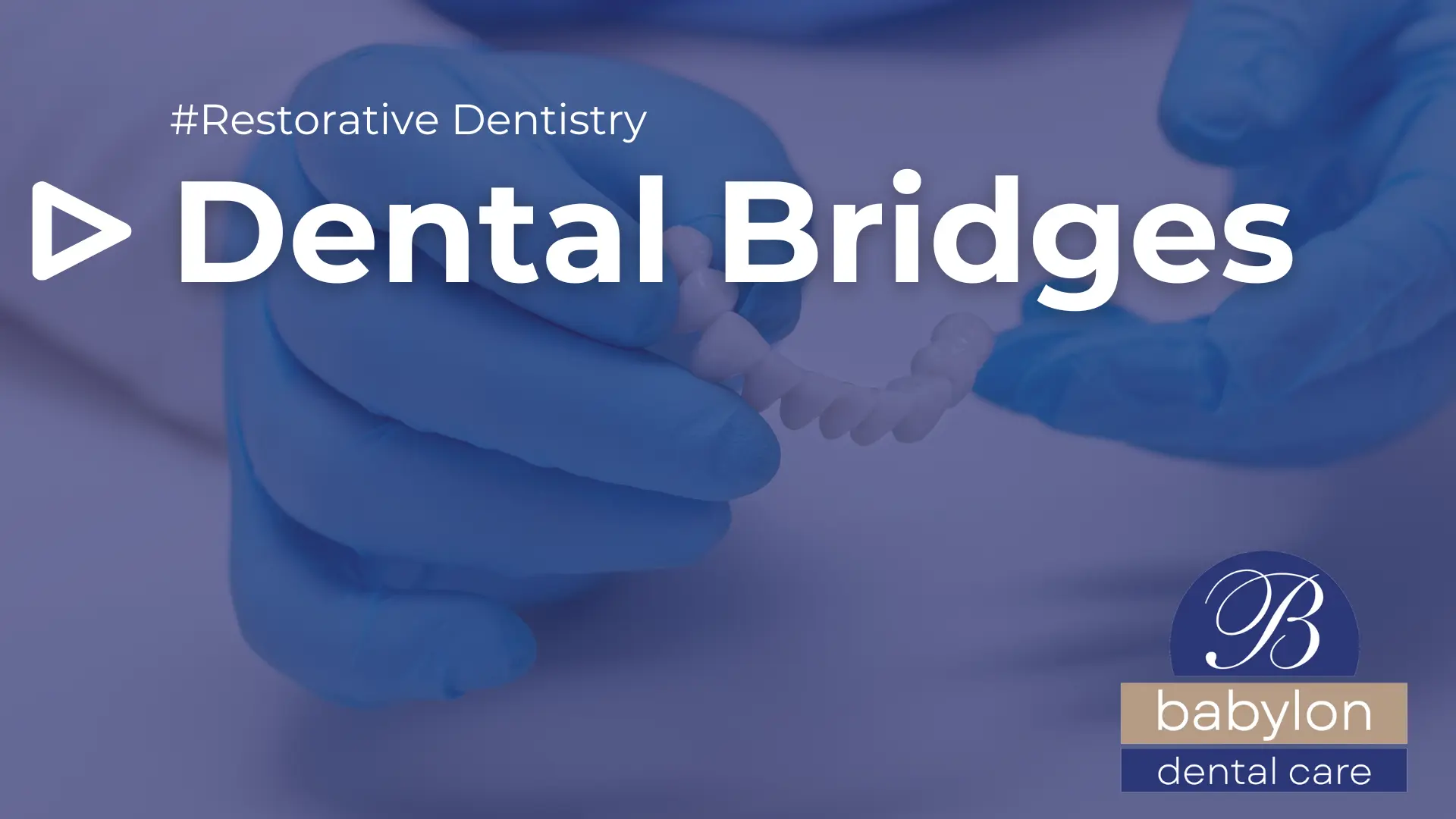 Dental-Bridges-Image-new-logo