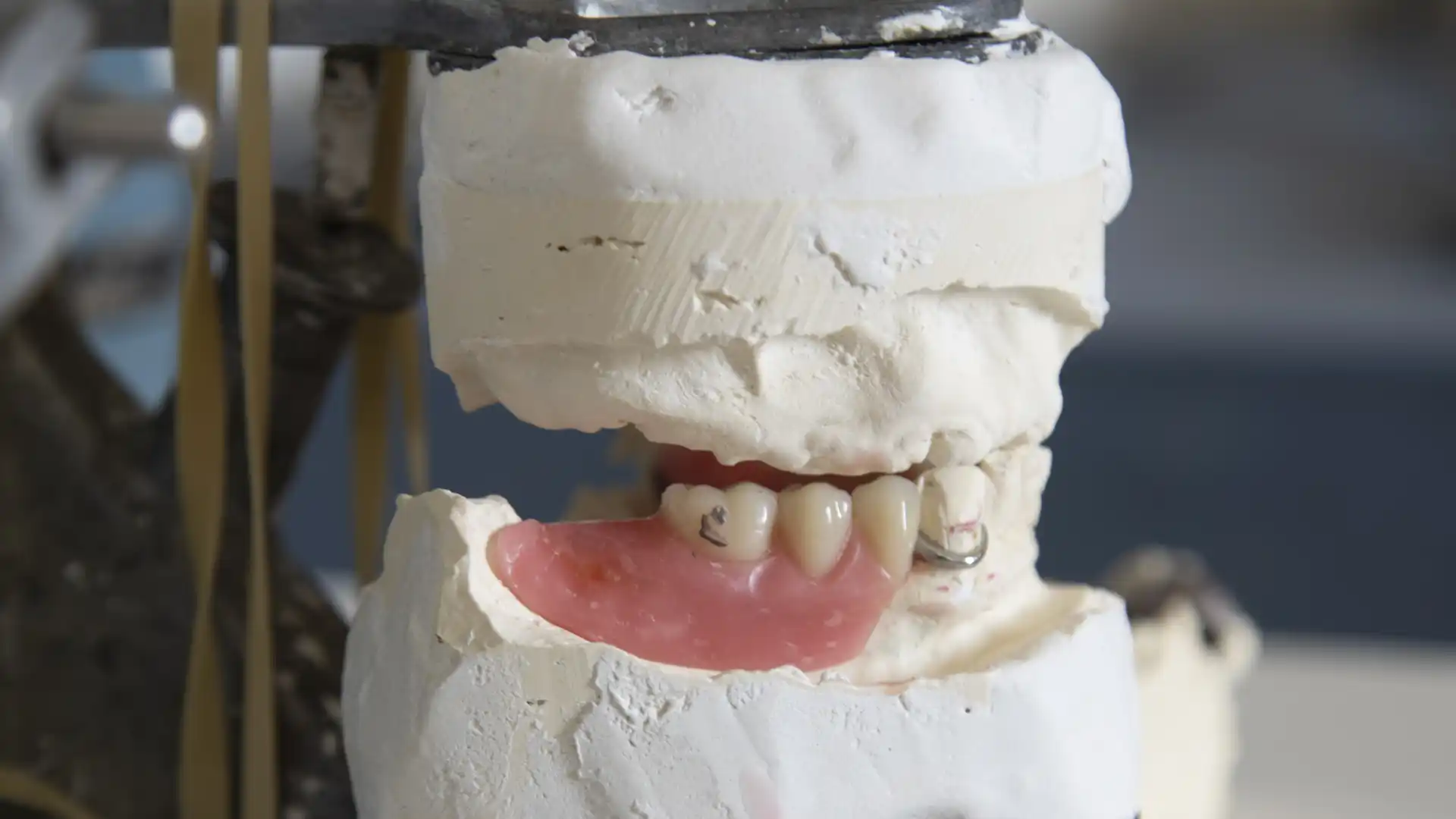Close-up of a dental mold with artificial teeth and gums