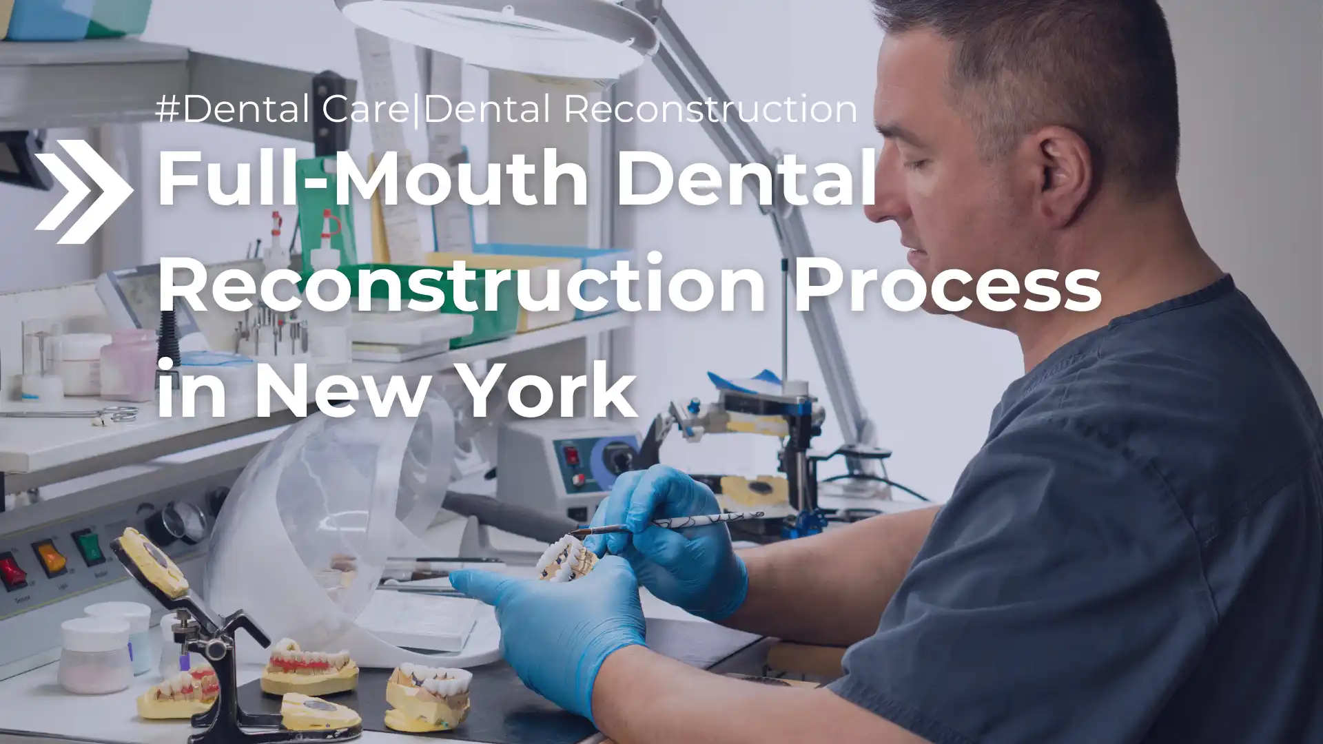 Full-Mouth Dental Reconstruction Process in New York Image