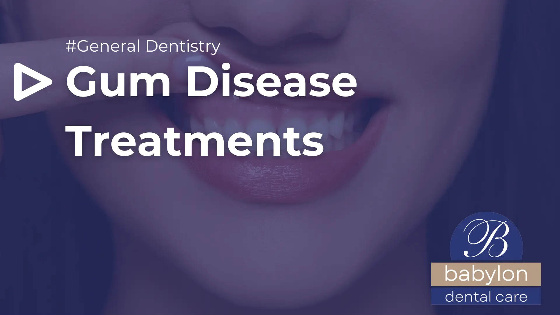 Gum-Disease-Treatments-Image-new-logo