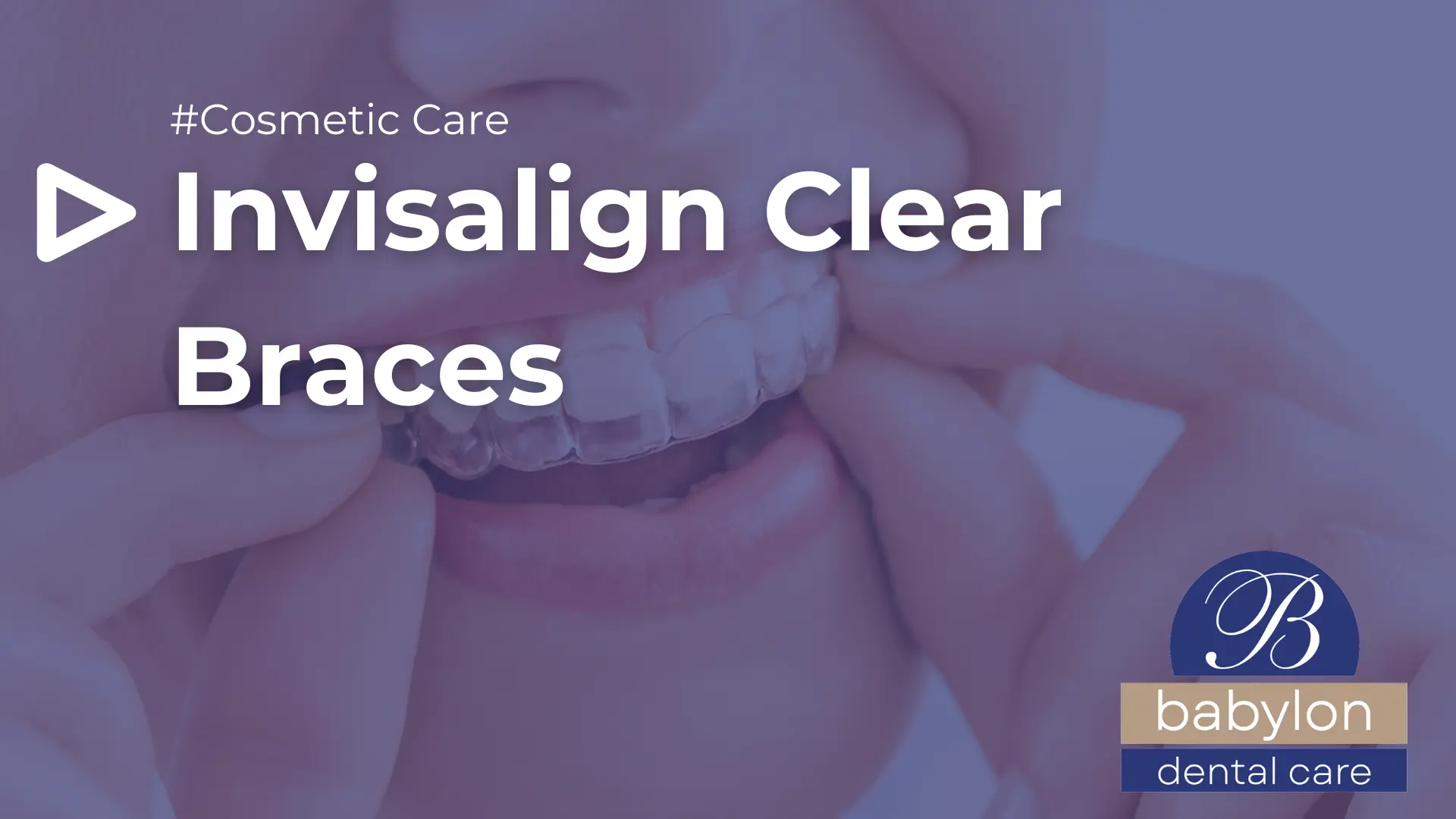 Invisalign clear braces