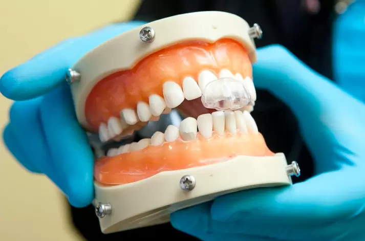 A dental professional wearing blue gloves holds a model of human teeth, demonstrating a bite guard or dental appliance.