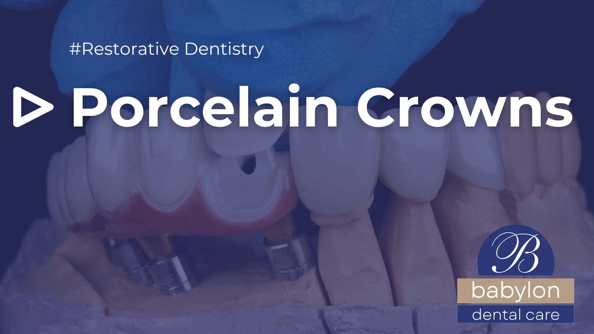 Porcelain-Crowns-Image-new-logo