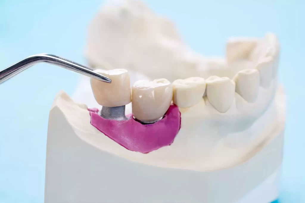 Restorative Dentistry