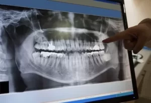 digital-radiography