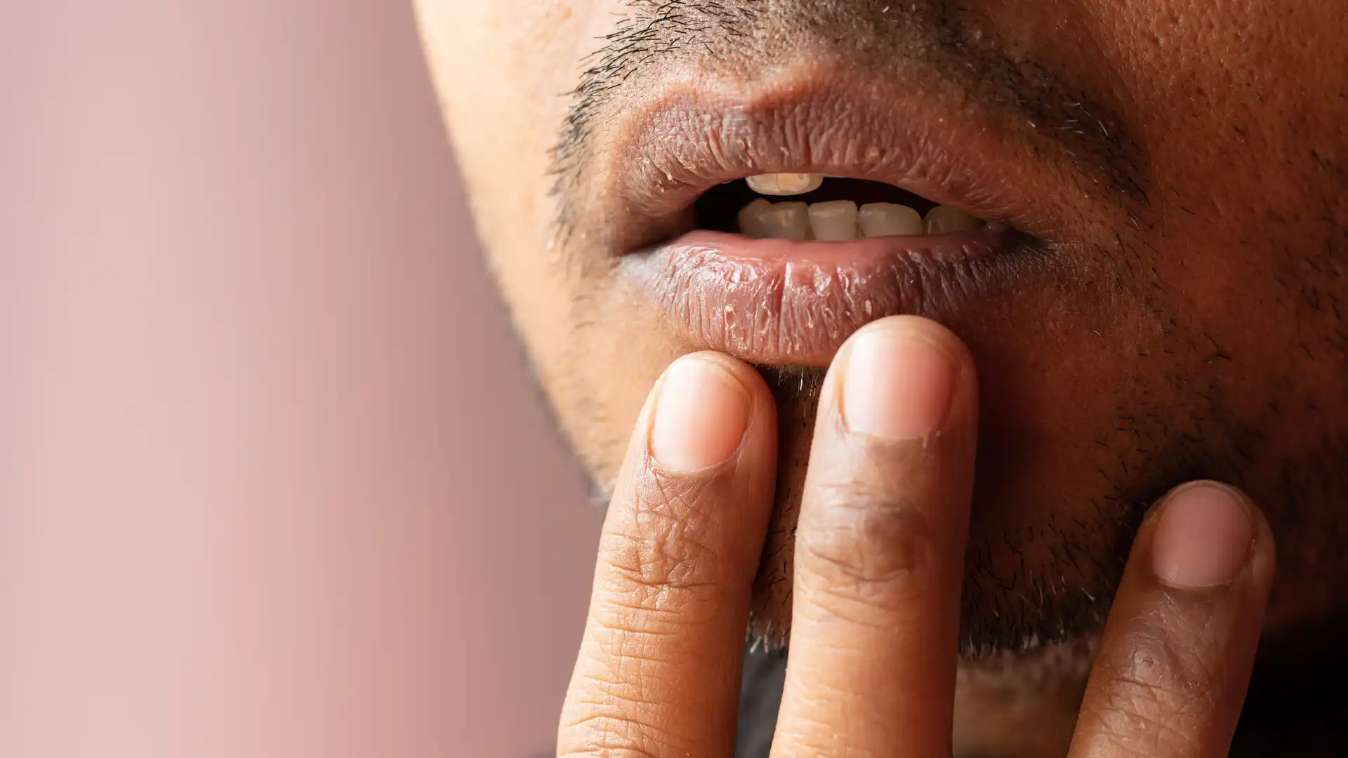 Natural Ways to Manage and Treat Dry Mouth Image 2