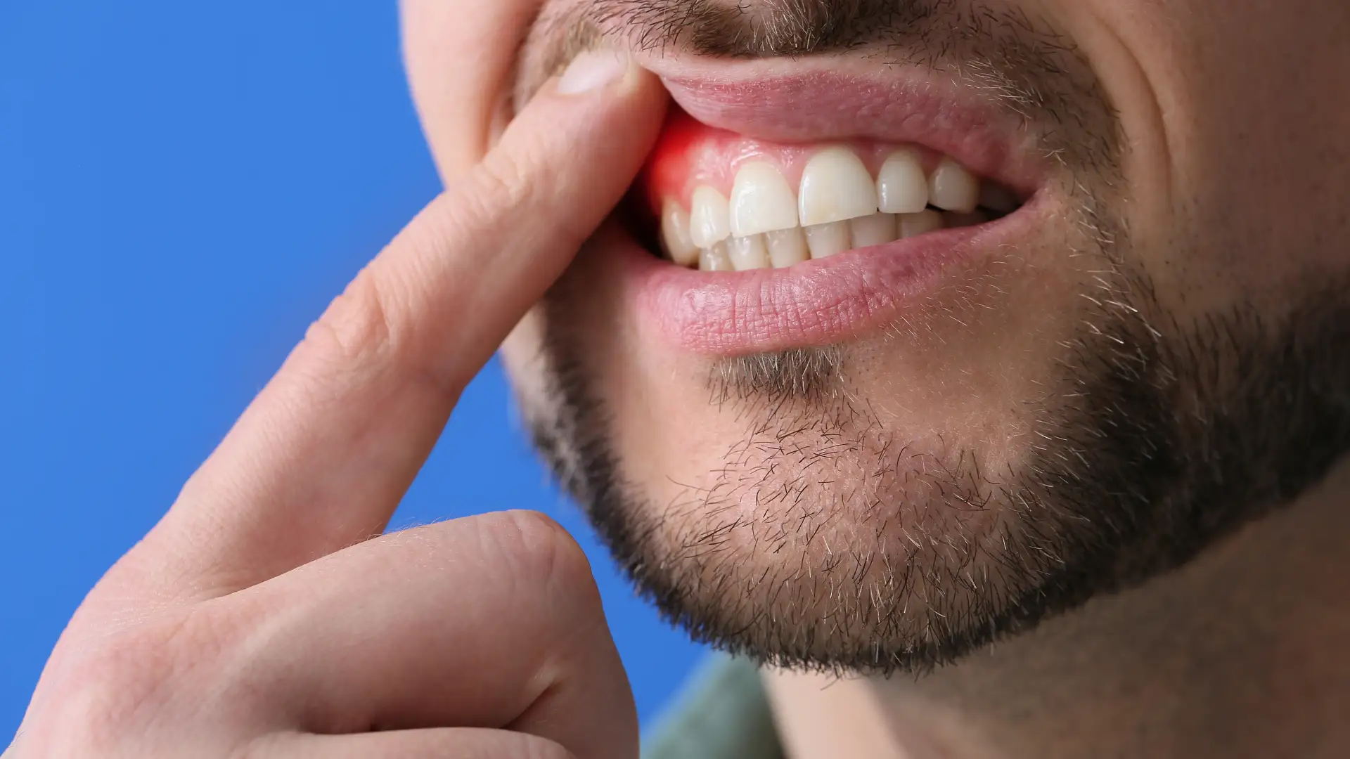 Man showing inflamed gums