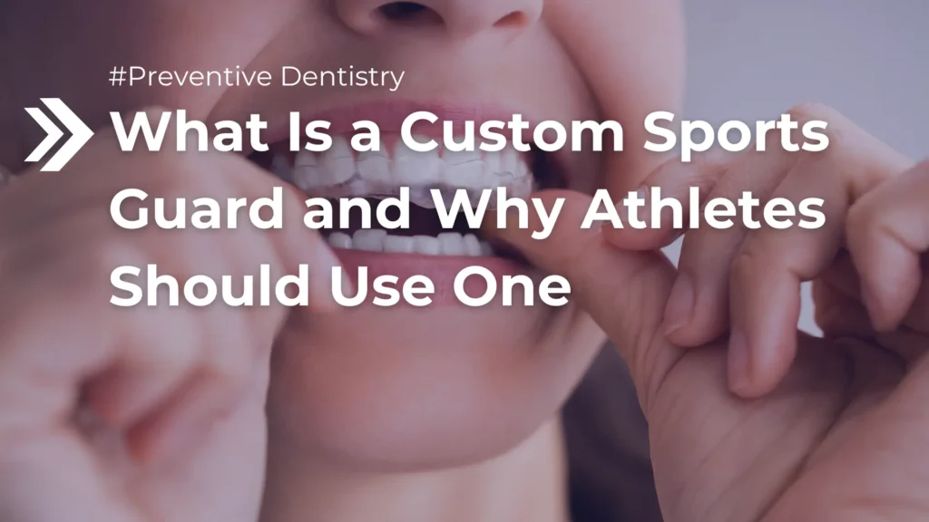 What Is a Custom Sports Guard and Why Athletes Should Use One Image