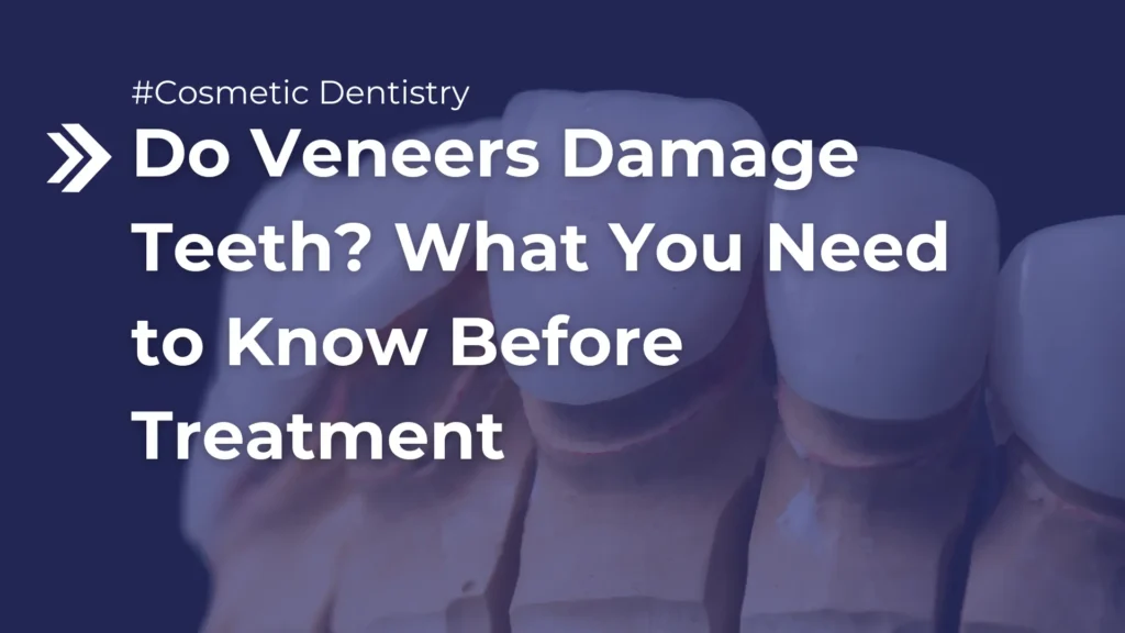 Do Veneers Damage Teeth_ What You Need to Know Before Treatment Image