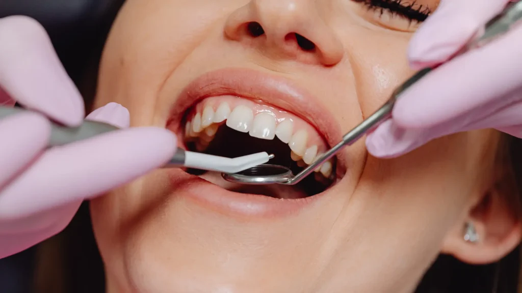 How Long Can Dental Implants Last_ Factors That Influence Their Lifespan Image 2