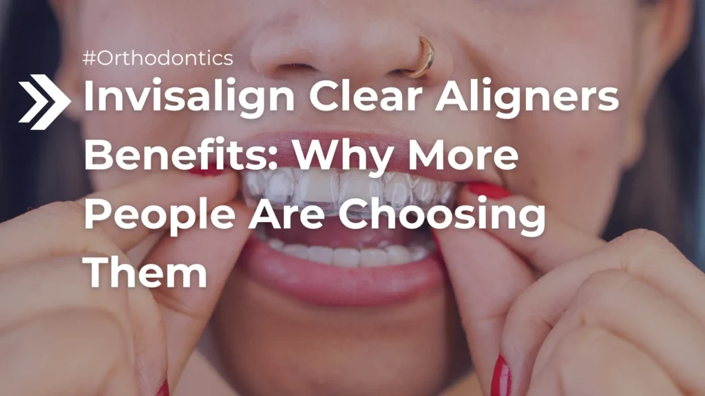 Invisalign Clear Aligners Benefits_ Why More People Are Choosing Them Image
