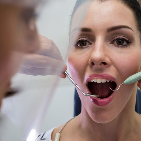 Woman with her mouth open during a dental consultation