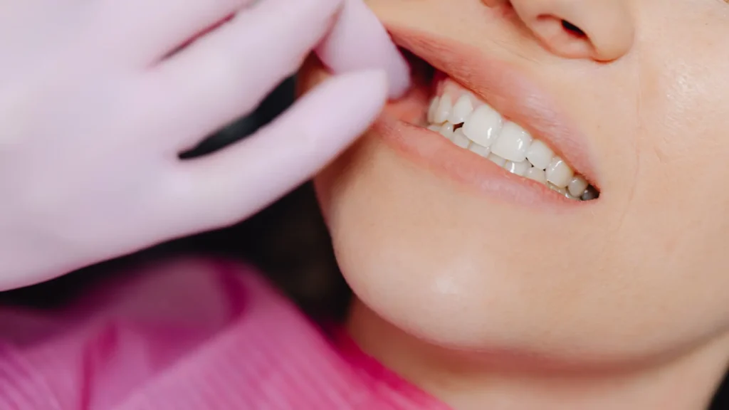 Oral Health Tips for People Using Nicotine Pouches Image 2