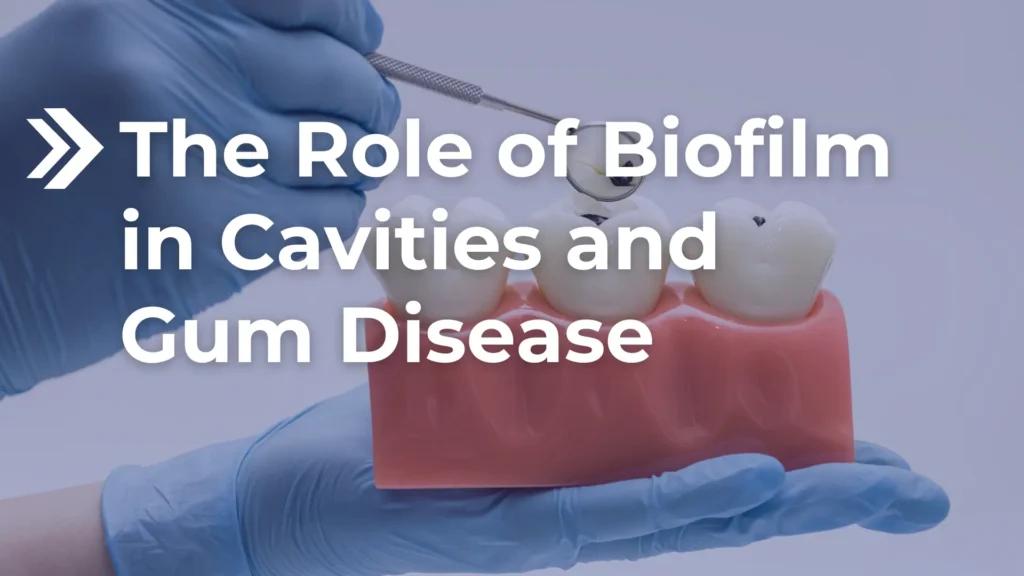 The Role of Biofilm in Cavities and Gum Disease Image