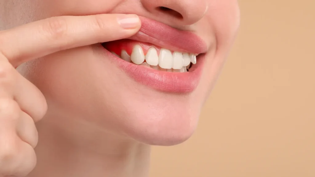 The Role of Biofilm in Cavities and Gum Disease Image 2