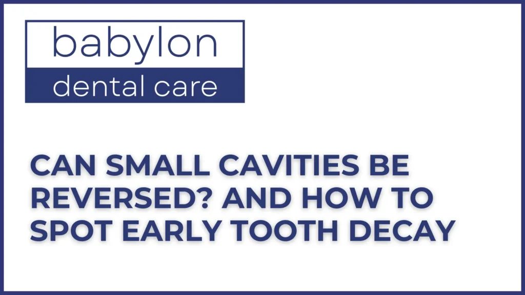Can Small Cavities Be Reversed_ And How to Spot Early Tooth Decay Image