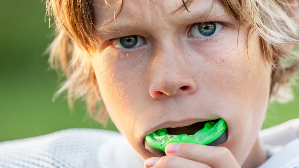 Kids’ Sports Mouthguards_ What Every Parent Needs to Know image 2