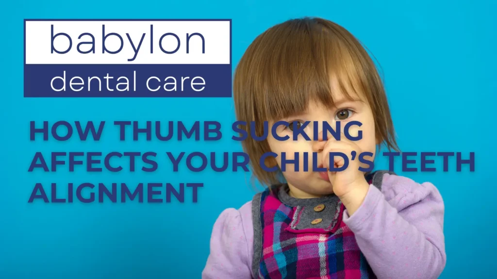 How Thumb Sucking Affects Your Child’s Teeth Alignment image