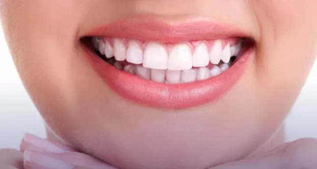 Woman's teeth